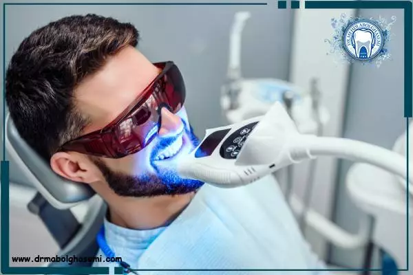 بلیچینگ دندان