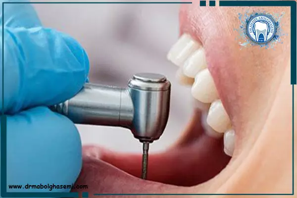درمان و ترمیم دندان آسیب دیده
