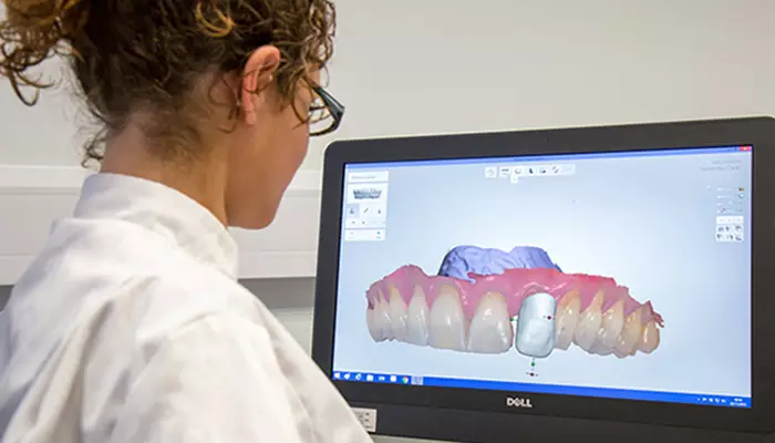 ایمپلنت دیجیتال از جدیدترین انواع ایمپلنت دندان