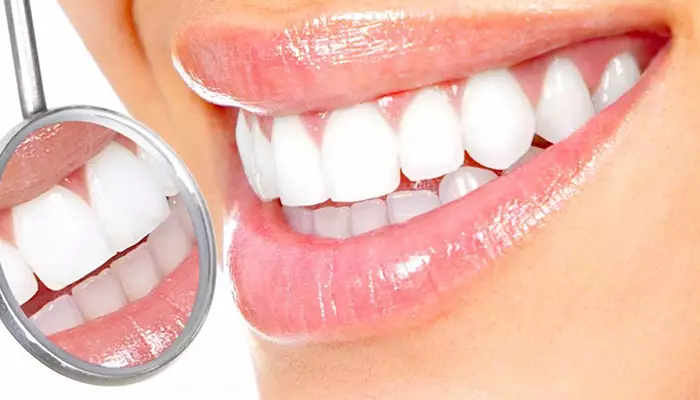 اهداف اصلاح طرح لبخند چیست